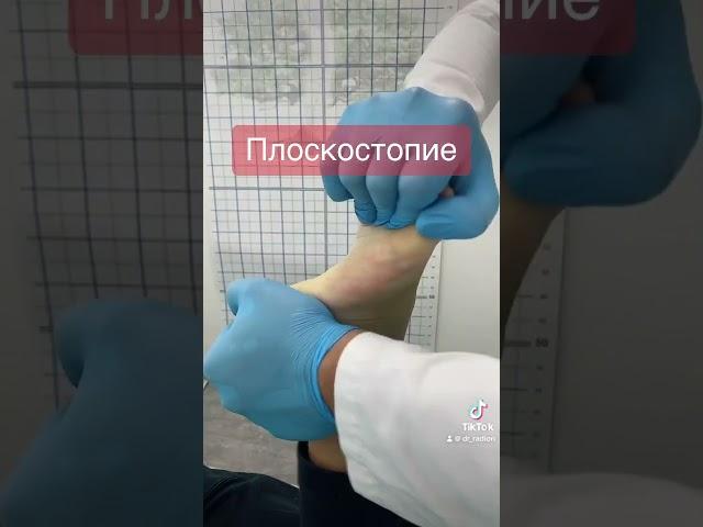 Лечение плоскостопия в 13 лет