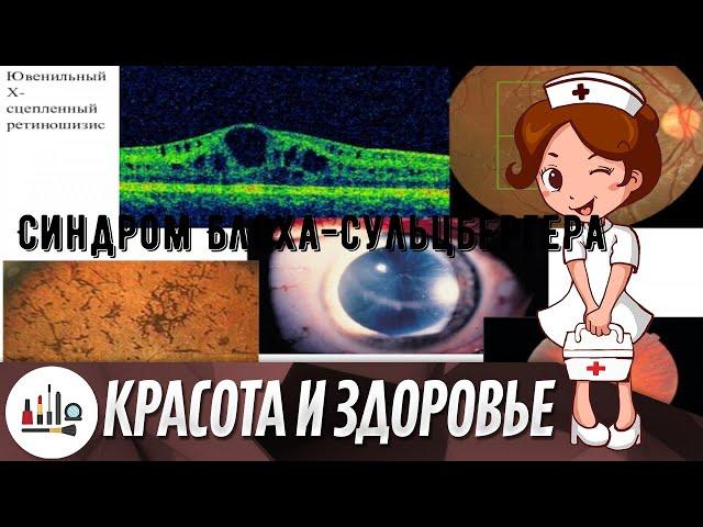 Синдром Блоха-Сульцбергера