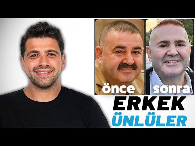 ESTETİK CERRAH, ERKEKLERİN ESTETİK OPERASYONLARINI AÇIKLIYOR!