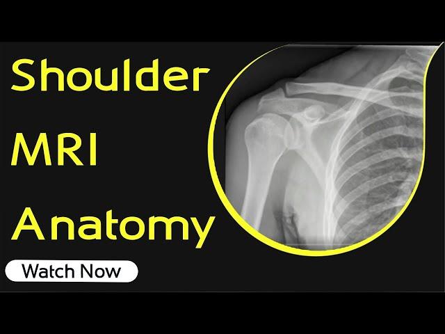 Shoulder MRI Anatomy | Orthopaedic Academy