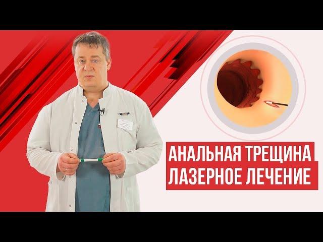 Анальная трещина - лазерное лечение