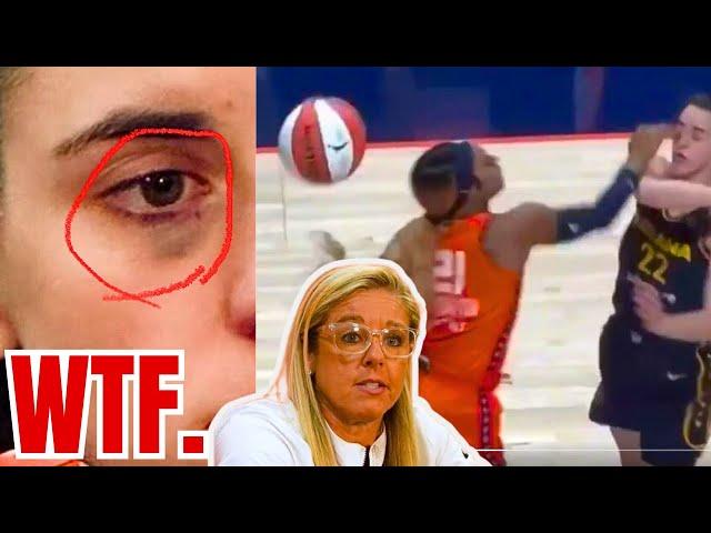 Caitlin Clark BLACK EYE BACKLASH! Christie Sides REFUSES to CALL OUT WNBA Referees for HEINOUS ACT!