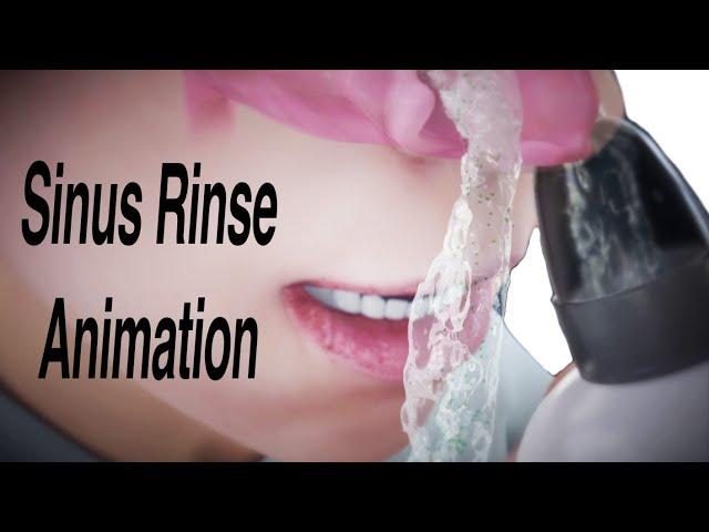 Sinus Rinse Animation