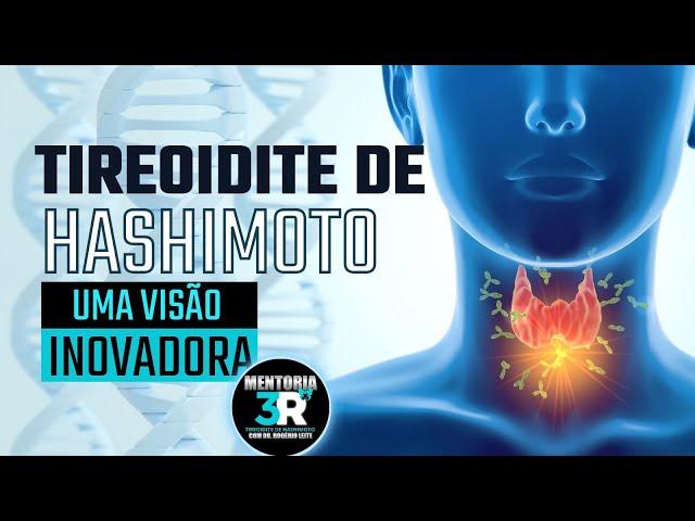 Tireoidite de Hashimoto: UMA VISÃO INOVADORA