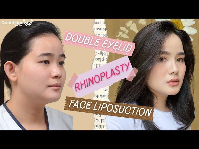 FACIAL PLASTIC SURGERY: SHEK'S TRANSFORMATION