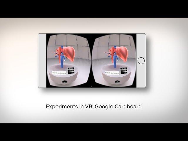 TVASurg Google Cardboard VR experiments