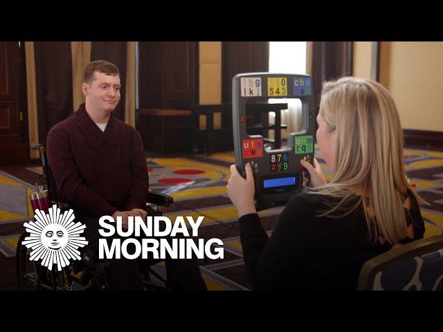 Surviving locked-in syndrome: How one man confounded expectations of death