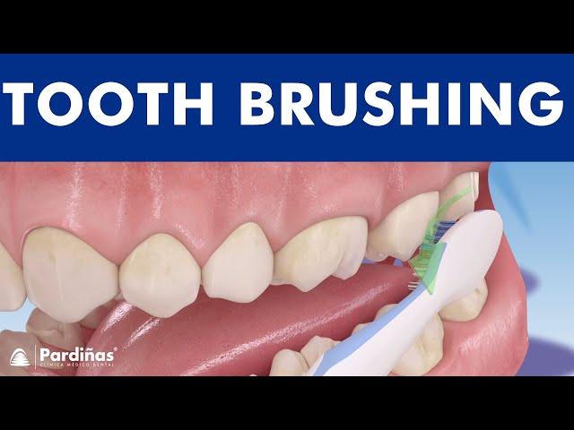 Tooth brushing – How to brush your teeth ©