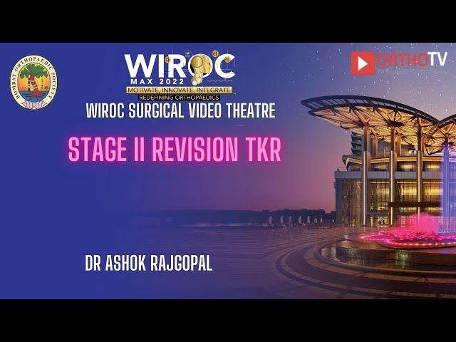 Stage II Revision TKR Dr Ashok Rajgopal