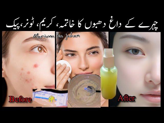 Dark spots Treatment,by Merium ka jahaan/How to Reduce dark spots on face, #darkspots