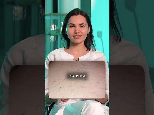 Прежде чем использовать эпилятор, посмотрите это видео! #косметология #эпиляция #волосы #красота