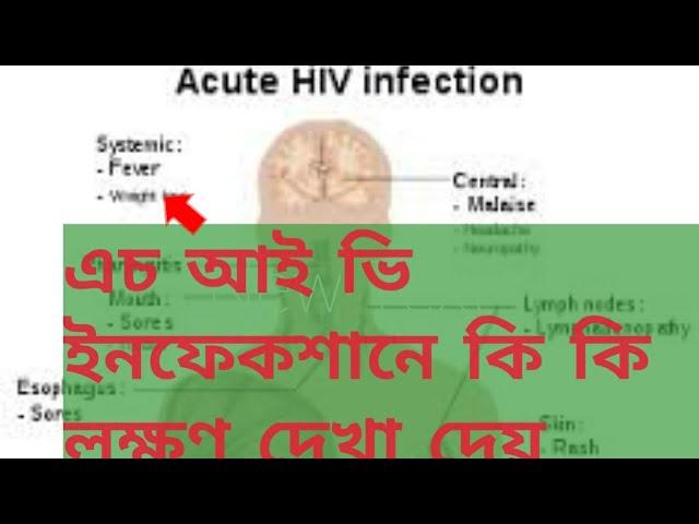 wat r the early symptoms of HIV infection|acute hiv syndrome|bengali