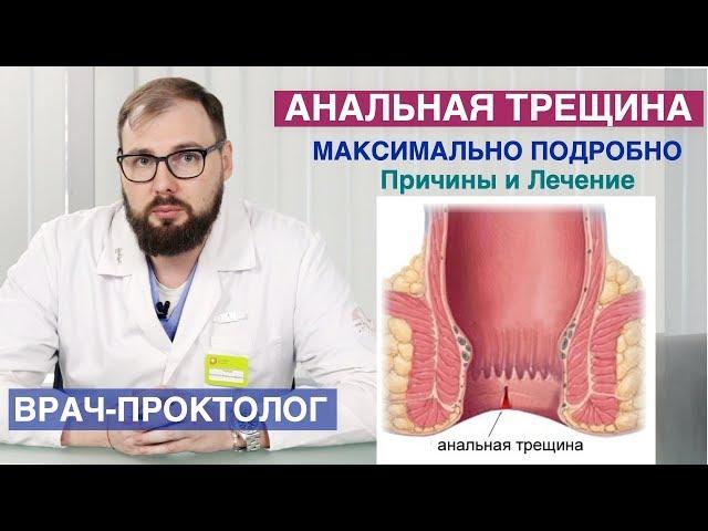 Анальная трещина - симптомы, причины, лечение, профилактика.