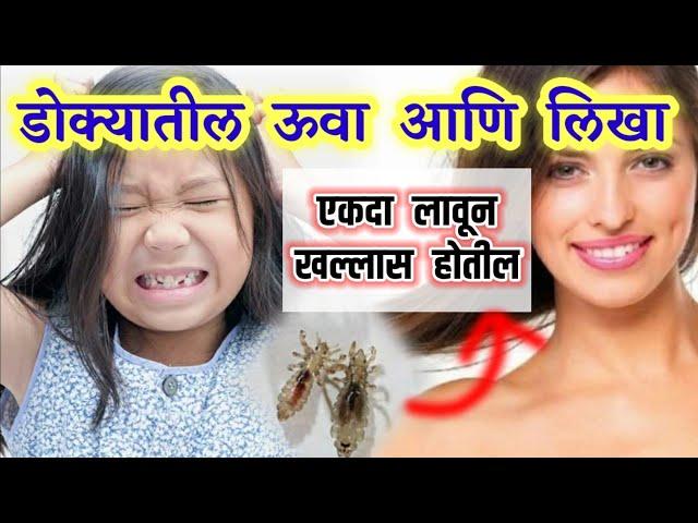 डोक्यातील ऊवा आणि लिखा एकदा लावून खल्लास होतील ! uva sathi gharguti upay