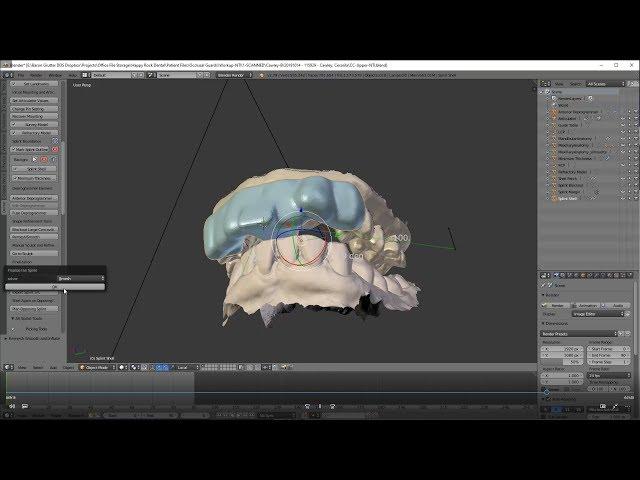 D3Splint - Anterior Deprogrammer Design