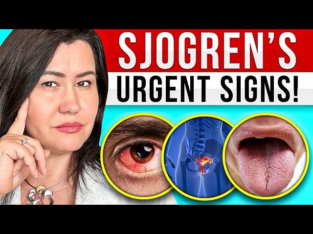 10 BAD SIGNS of Sjogren’s Syndrome - A Very Complex Autoimmune Disease