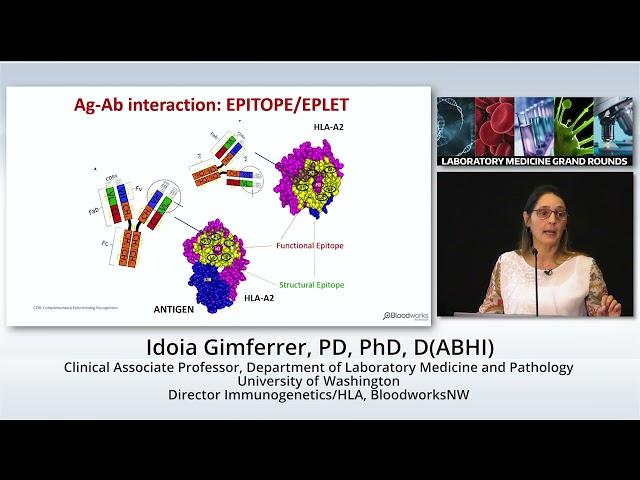 HLA and Transplantation