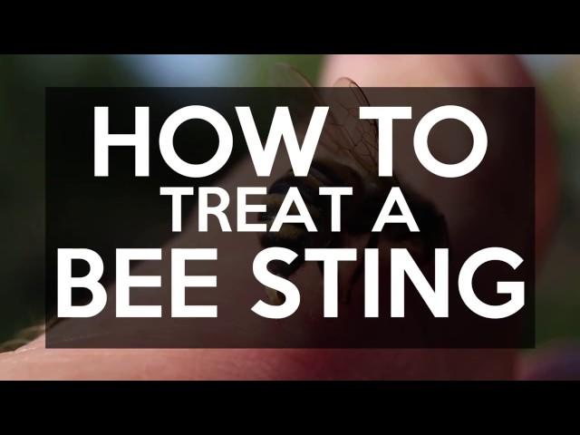 How to Treat a Bee Sting