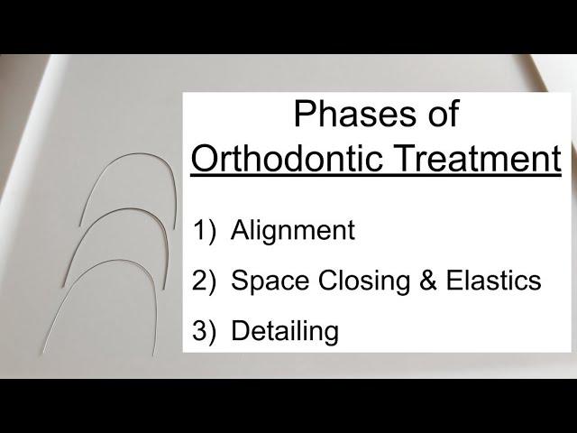 Phases of Tx & Wire Sequence