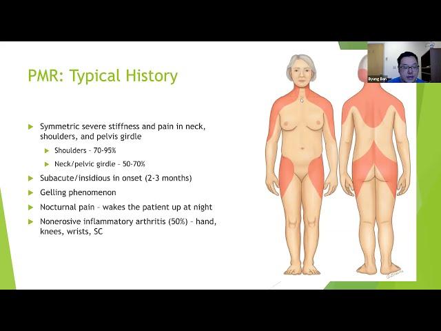 Polymyalgia Rheumatica (PMR) and Giant Cell Arteritis (GCA)