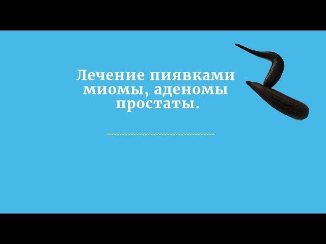 Лечение пиявками миомы, аденомы простаты.