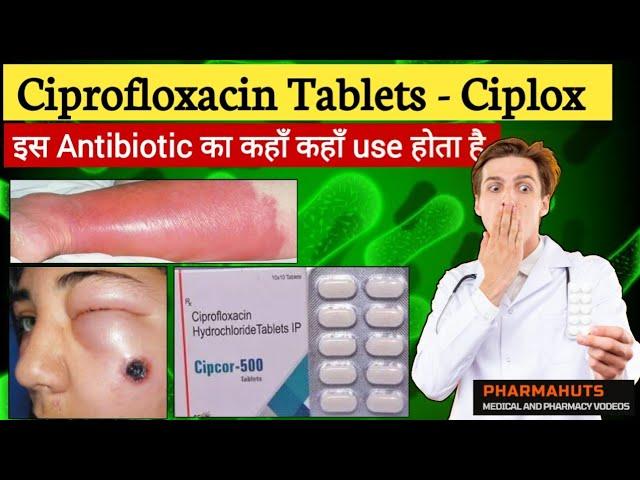 Ciprofloxacin tablet | Ciplox tablet | Zoxan tablet, uses , side effects in hindi | Medicine info