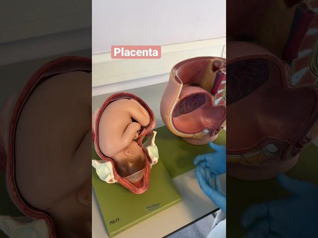 Placenta previa #mbbs #medical #anatomy #pregnancy