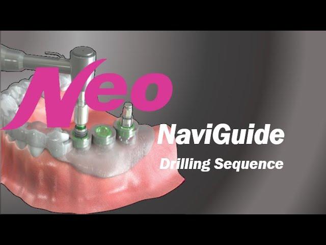 NaviGuide: Drilling Sequence