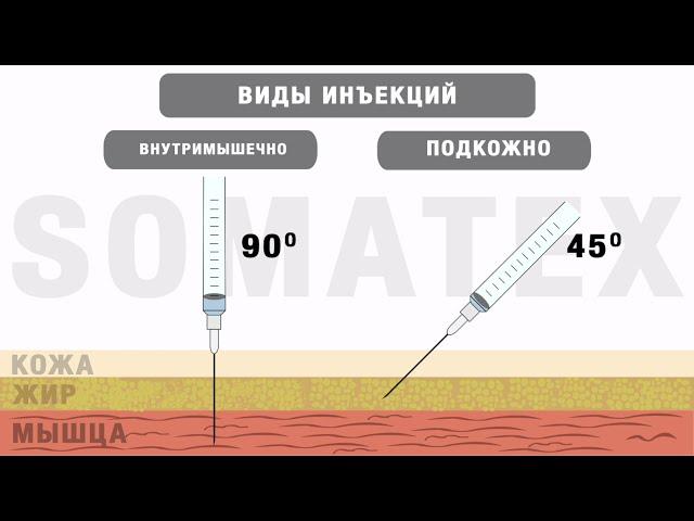 Виды инъекций