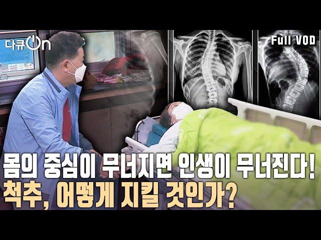 중.장년층만의 문제는 아니다! 젊은층에서 늘어나고 있는 척추질환. 우리 몸의 중 '척추'를 지켜라!  [다큐온 KBS 20201128 방송]