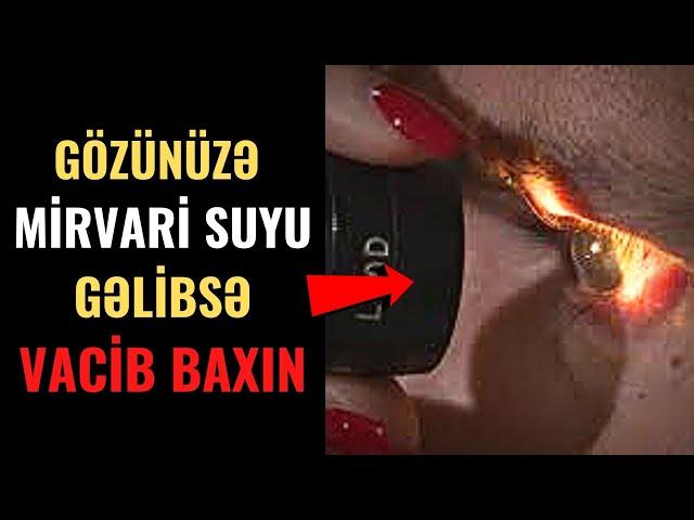 MÜTLƏQ BAXMALISIZ! - Gözünüzə Mirvari Suyu gəlibsə...