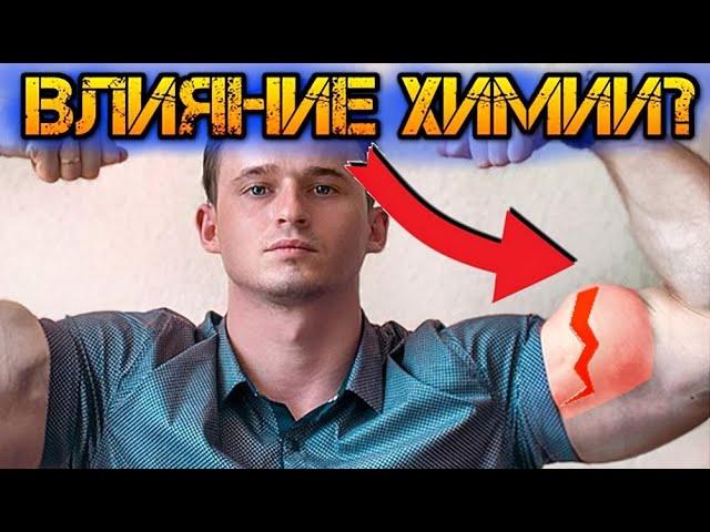 РАЗРЫВ БИЦЕПСА! последствия химии?