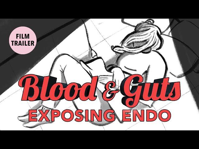 BLOOD & GUTS: Exposing Endo [Trailer]