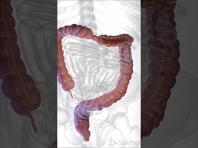  Diarrhea: When the Intestines Lose Control 