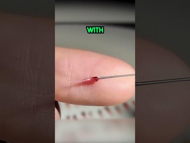 This is INSANE! Berry Surgery! 