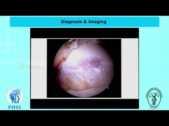 Diagnosis and Imaging