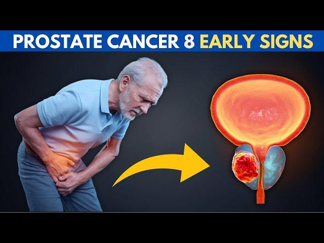 Don’t Miss These 8 Early PROSTATE CANCER Signs – They Could Save Your Life!