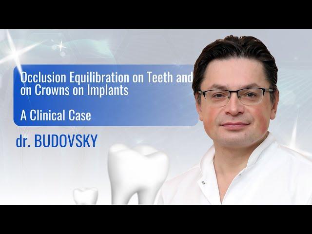 Occlusion Equilibration on Teeth and on Crowns on Implants