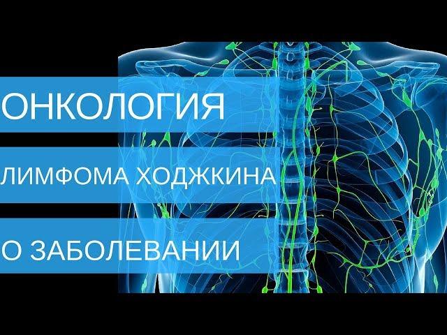 ЛИМФОМА ХОДЖКИНА - о заболевании | Добрый Прогноз