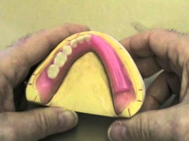 30 Setting Denture Teeth - Reference Lines