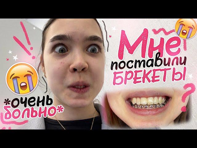 VLOG  Мне ПОСТАВИЛИ БРЕКЕТЫ *очень больно*