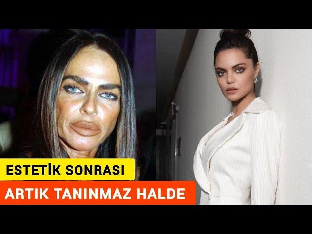 Estetik Sonrası Tanınmaz Hale Gelen Ünlüler!