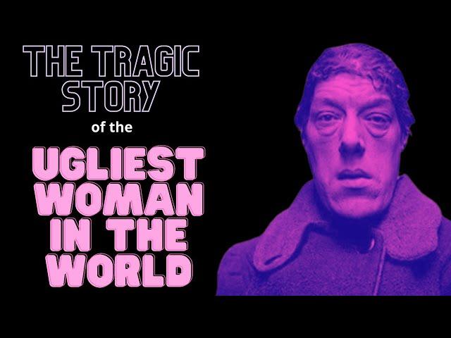 The Tragic Story Of Mary Ann Bevan | The Ugliest Woman In The World