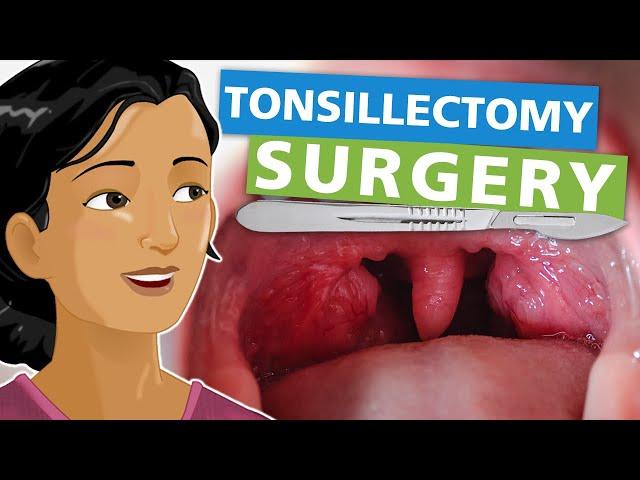 Tonsillectomy Surgery