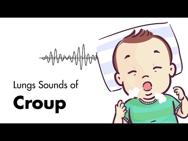 Sounds of Croup (Laryngotracheitis) - Lung Sounds - MEDZCOOL