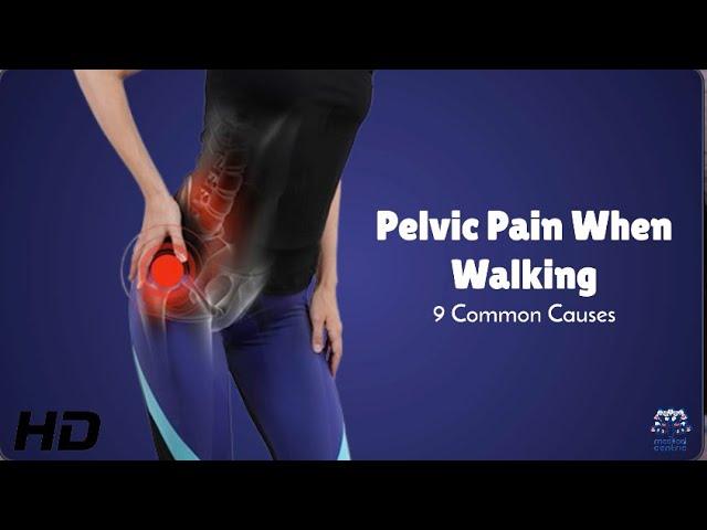 Pelvic Pain While Walking? Top 9 Causes You Shouldn't Ignore!