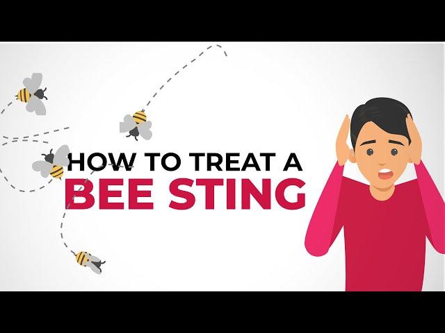 How to treat a bee sting