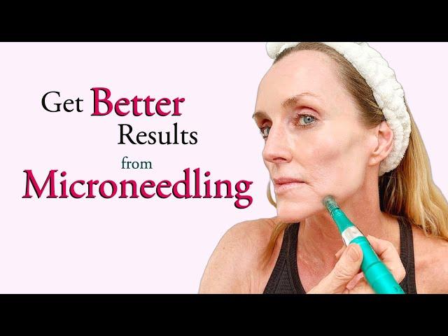 A BETTER way to Microneedle- Full Demo & The Difference between Cosmetic & Medical Microneedling