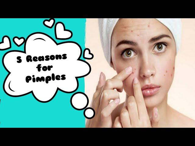 5 Major Resons for pimples ||skin care||Removal of pimples||Tipsify #pimples #PimpleReasons