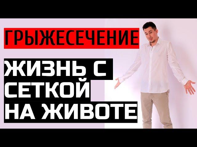 Грыжесечение | Жизнь с сеткой на животе